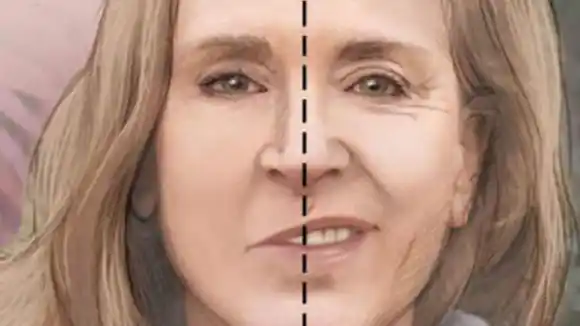 Causas y consecuencias de la parálisis facial