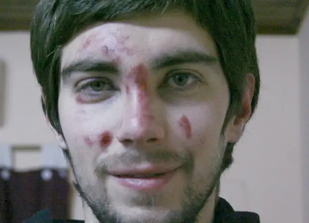 Un joven fue víctima de una brutal golpiza para sacarle 300 pesos