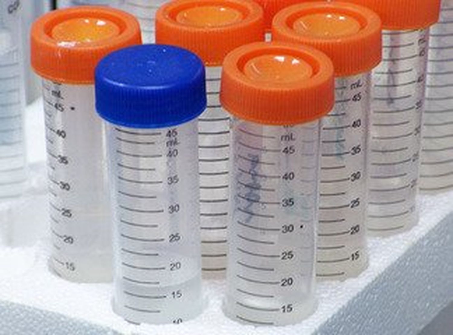 Difteria reaparece en Perú y Venezuela apoya alerta