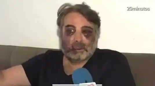 Le pidió a sus vecinos que hicieran silencio, pero lo desfiguraron a golpes