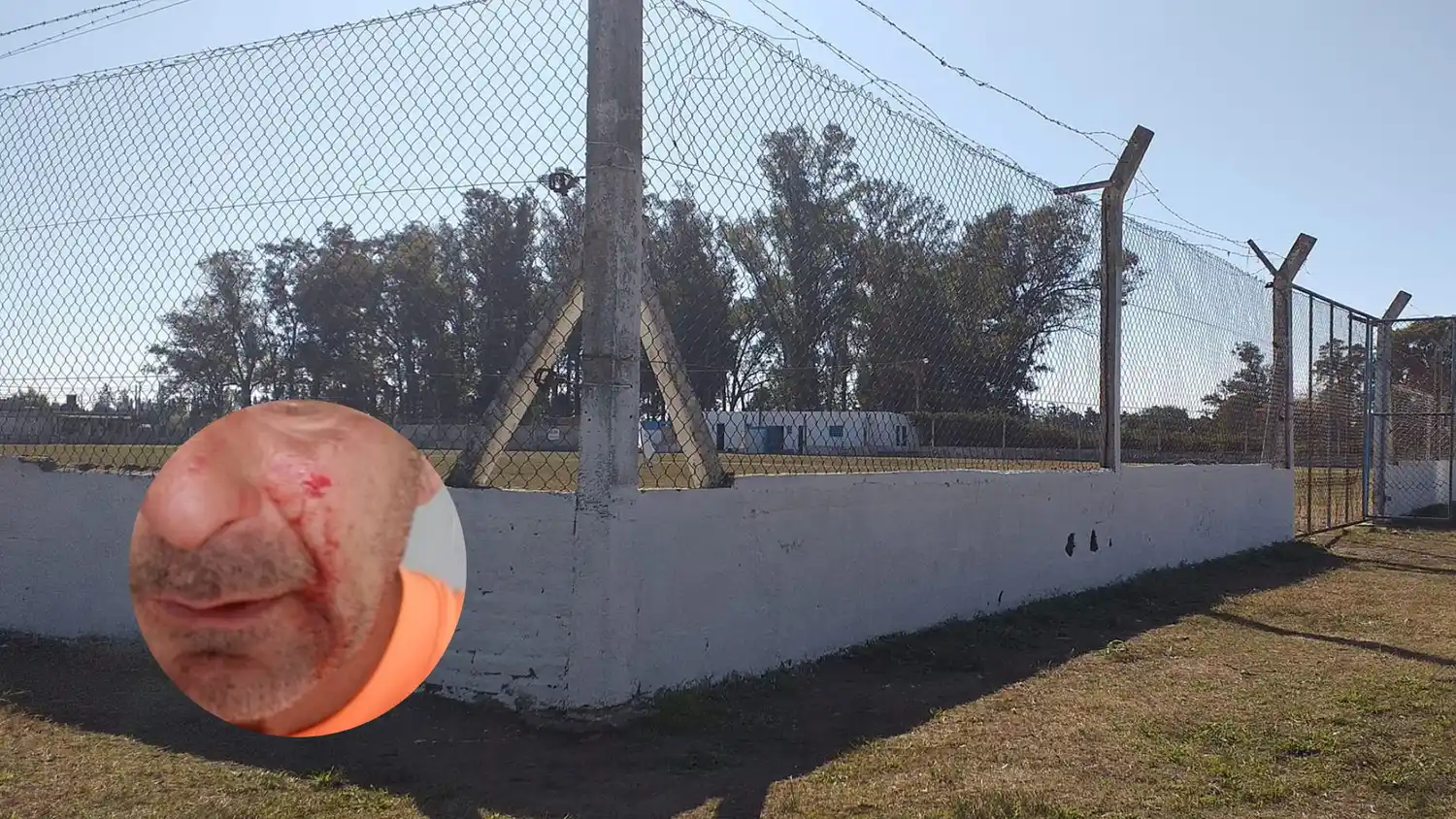 Fútbol Violento: lo expulsaron, golpeó al árbitro y fue detenido