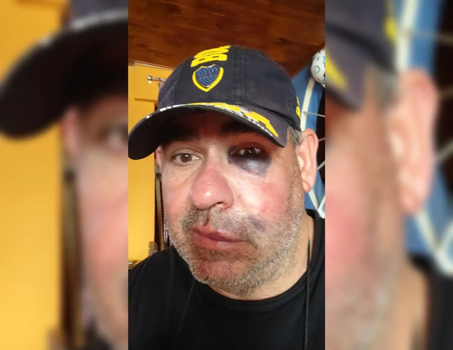 Uatre Río Tala: desde la lista opositora aseguraron que a Giménez le pegaron “en defensa propia”