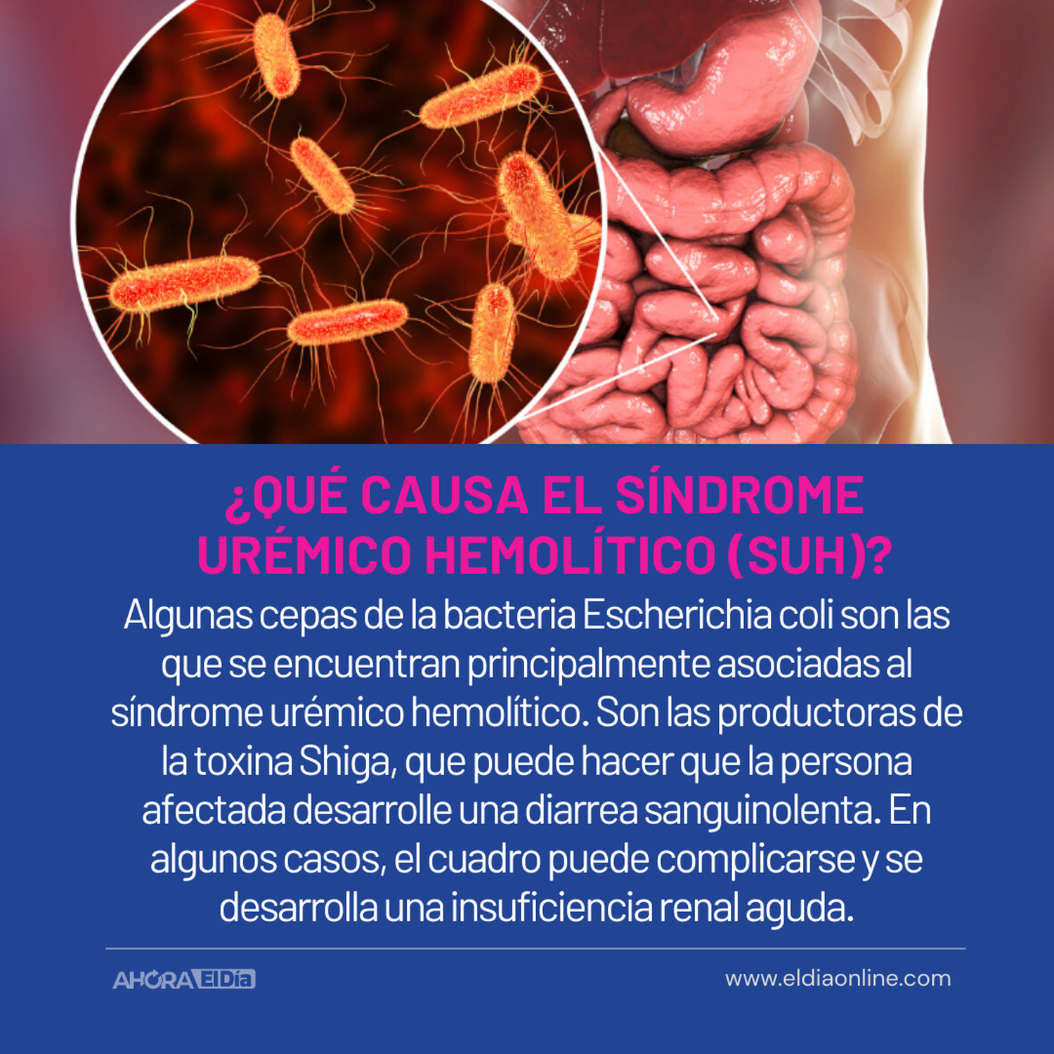 Síndrome Urémico Hemolítico: Cómo prevenir la enfermedad de la “Carne Cruda” - 4