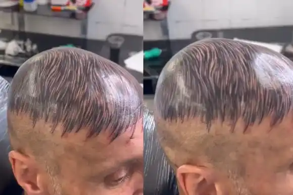 Se tatuó la cabeza para disimular la calvicie y el resultado dejó a todos boquiabiertos