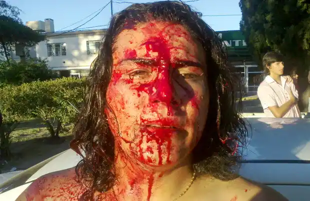 Denunció apremios ilegales y la Policía cree que es premeditado