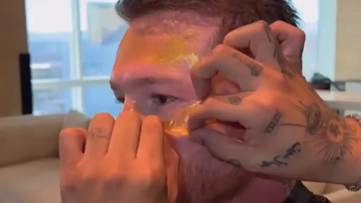 Mascarilla de Oro-Canelo Álvarez - Interna 1