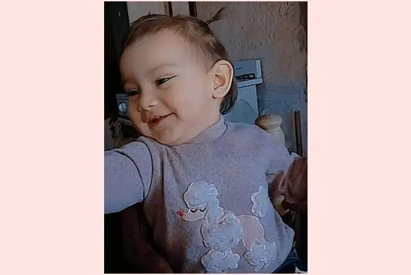 Iniciaron una campaña para ayudar a Loli, una bebé que será intervenida por una escafocefalia