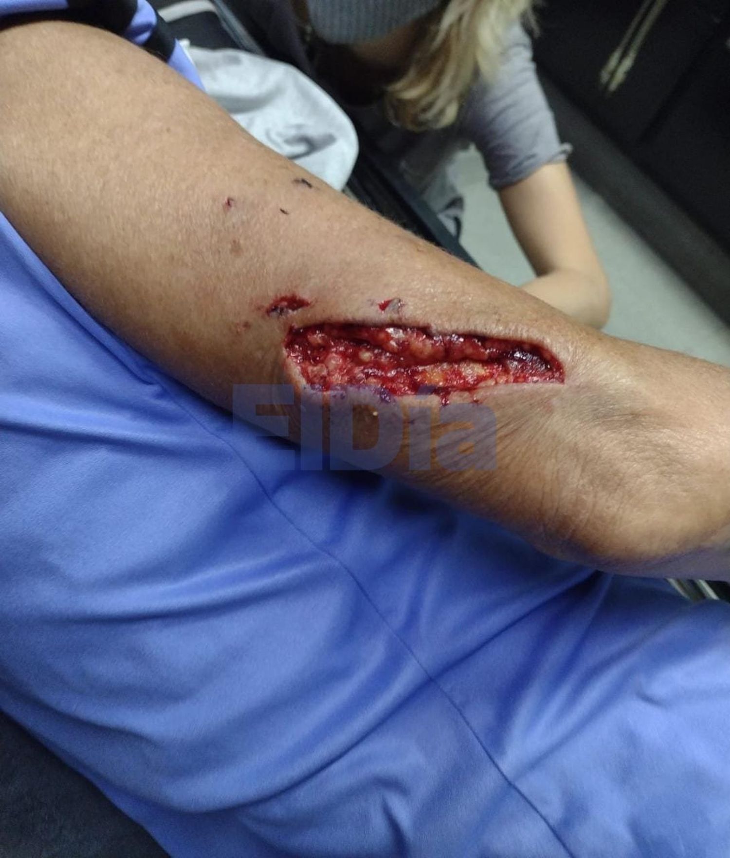 Un perro atacó a una mujer mientras corría en el Parque Unzué
