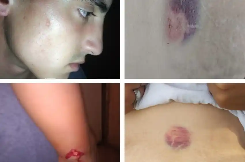 Denuncian grave violencia policial contra dirigentes de Barrios de Pie