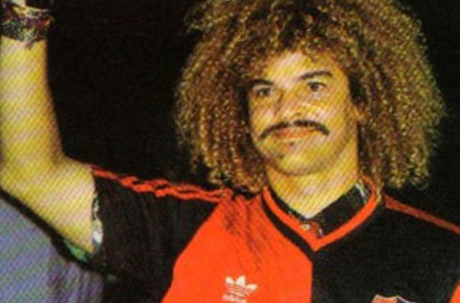 El Pibe Valderrama fue leproso, ¡por un día!