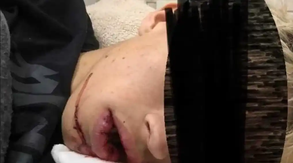 Otra salvaje golpiza: un joven de 19 años está internado tras ser atacado en una fiesta en Luján