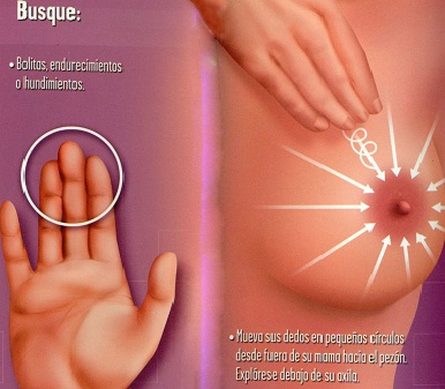 Para hablar de cáncer de mama hay que hacerlo claro y sin eufemismos
