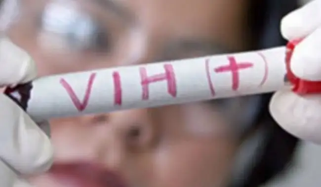El 62% de los pacientes con VIH de Gualeguaychú son hombres