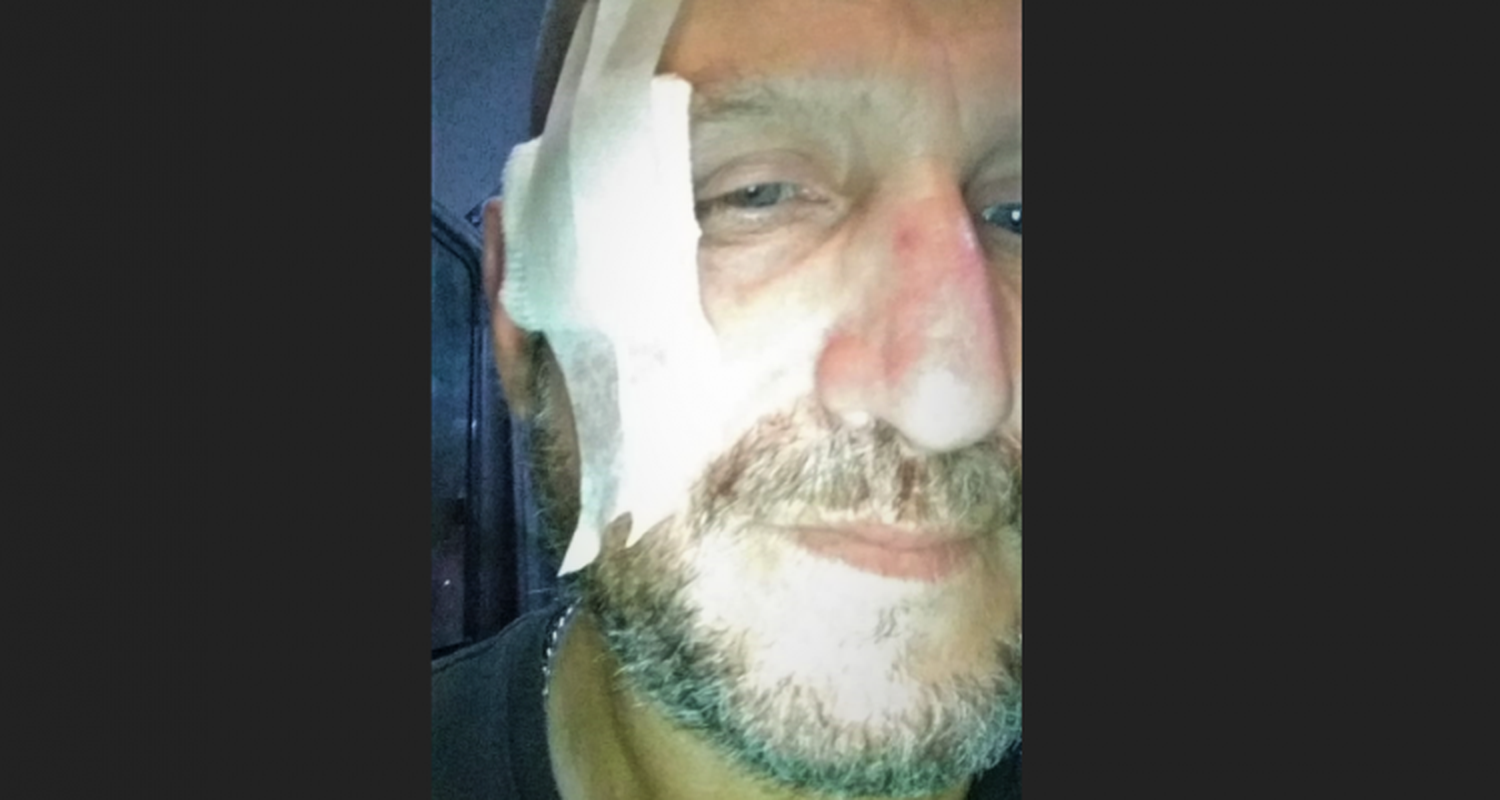 Asaltaron a un sereno en la playa de camiones y le dispararon a la cabeza
