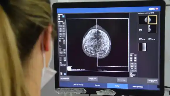 El gobierno bonaerense adelantó a los 40 años la edad para realizar la primera mamografía