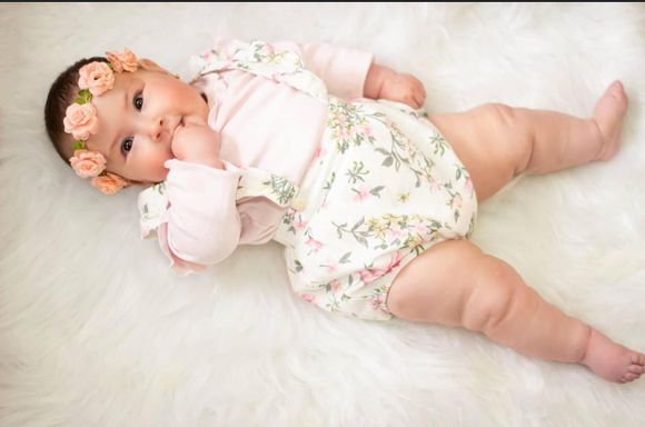 Amélie, la beba que necesitaba un halo chaleco, fue operada con éxito