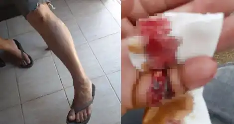 Reclamo: Se cayó de la bici por “el mal estado de la calle”