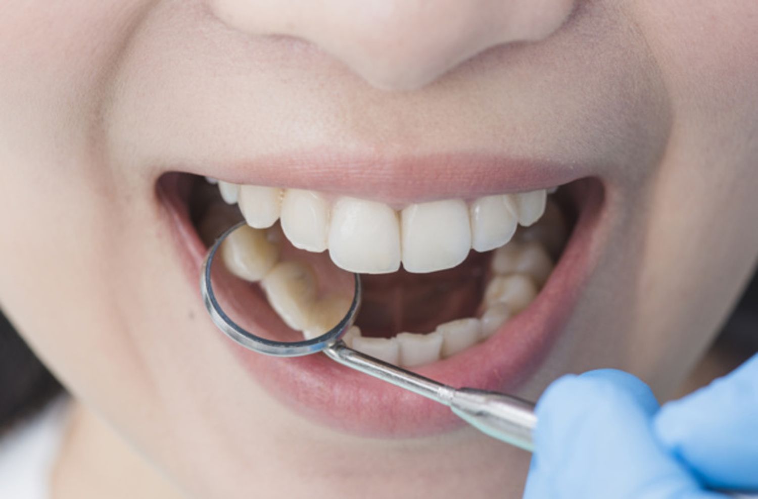 Cuidado dental en niños y adultos