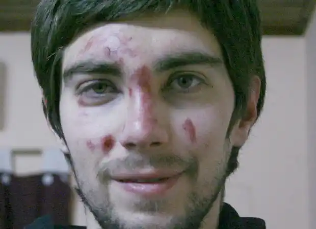 Un joven fue víctima de una brutal golpiza para sacarle 300 pesos