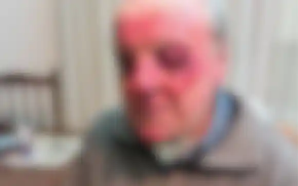 Violenta golpiza a un jubilado de 90 años en Miramar