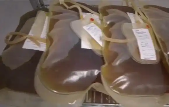 AVANCES CIENTÍFICOS Desarrollan un suero contra la covid-19 a través del plasma de caballos