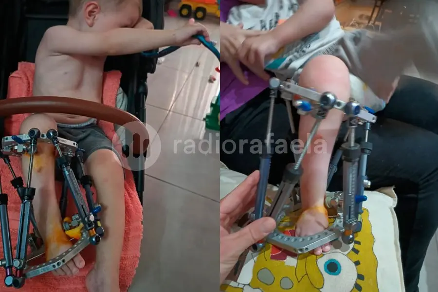 Corte de Iapos: la lucha de una madre para operar a su hijo 