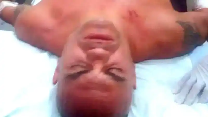 Dieron de alta a "La Hiena" Barrios tras ser apuñalado en confuso episodio