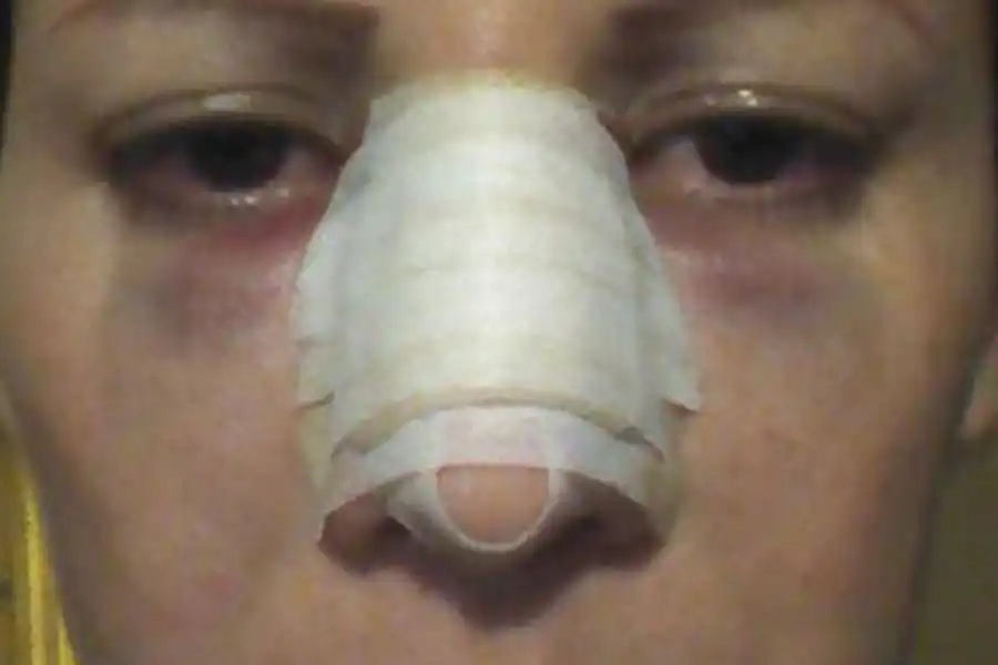 Preocupante hecho violento: noqueó a su madre de una trompada y le fracturó la nariz