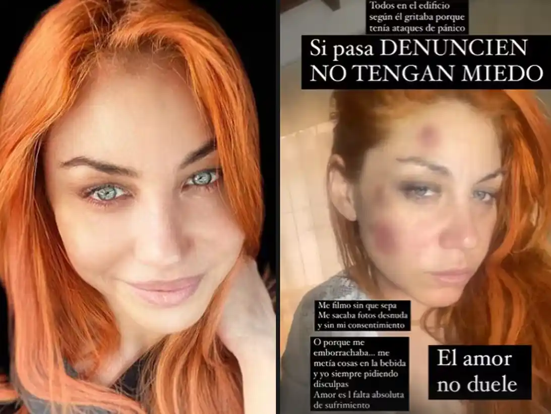 Lowrdez de Bandana contó cómo fue quedar atrapada en una relación violenta