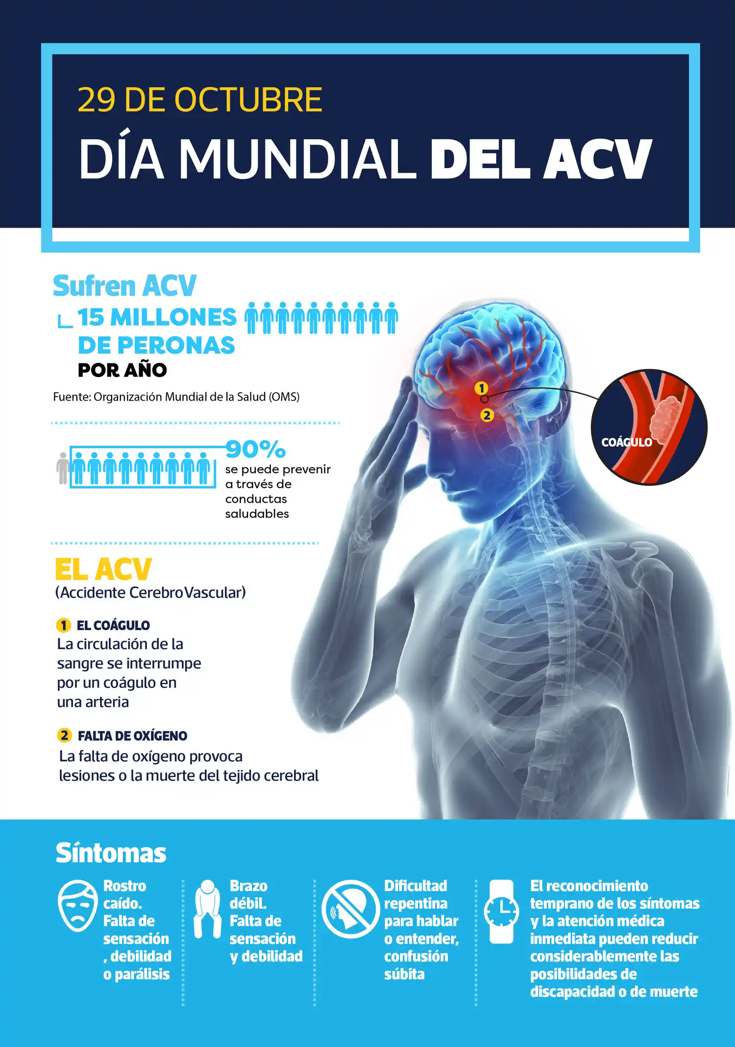 ACV: Actuar rápido hace la diferencia