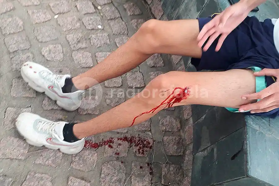 Dos menores apuñalaron a otro y le provocaron una lesión que requirió de intervención médica