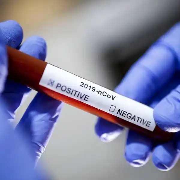 El Departamento Concordia confirmó 109 nuevos casos de coronavirus