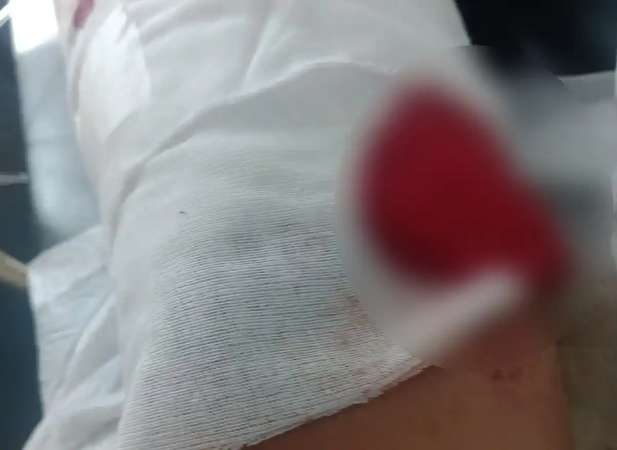 herida joven baleado