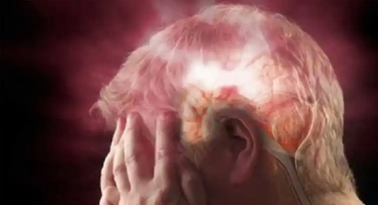 ACV: cómo se puede prevenir al detectar las primeras señales