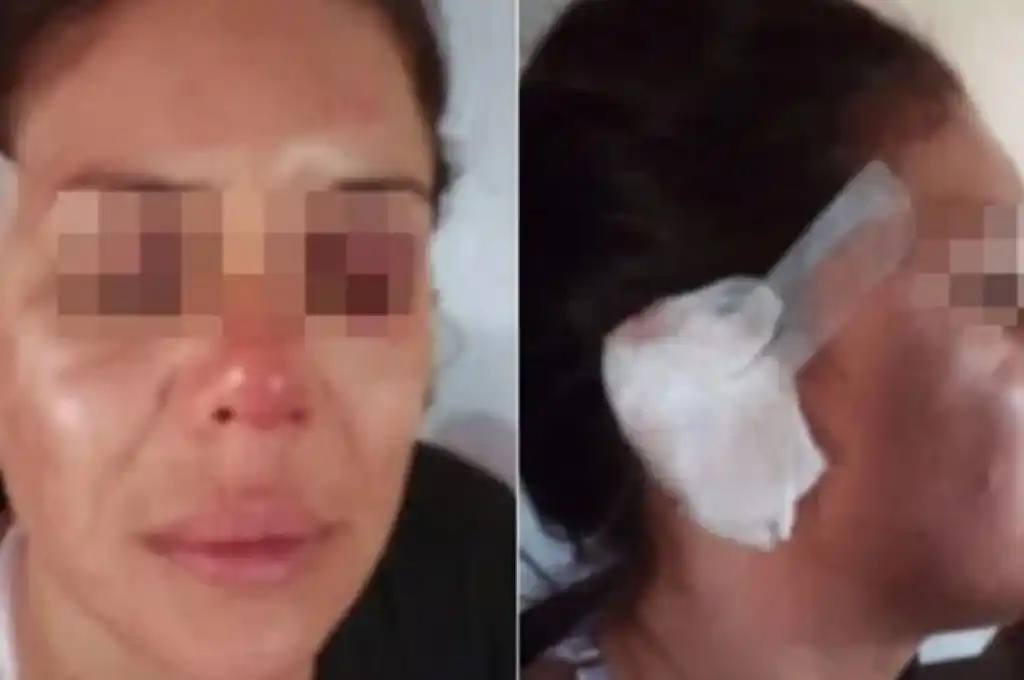 Violencia de género