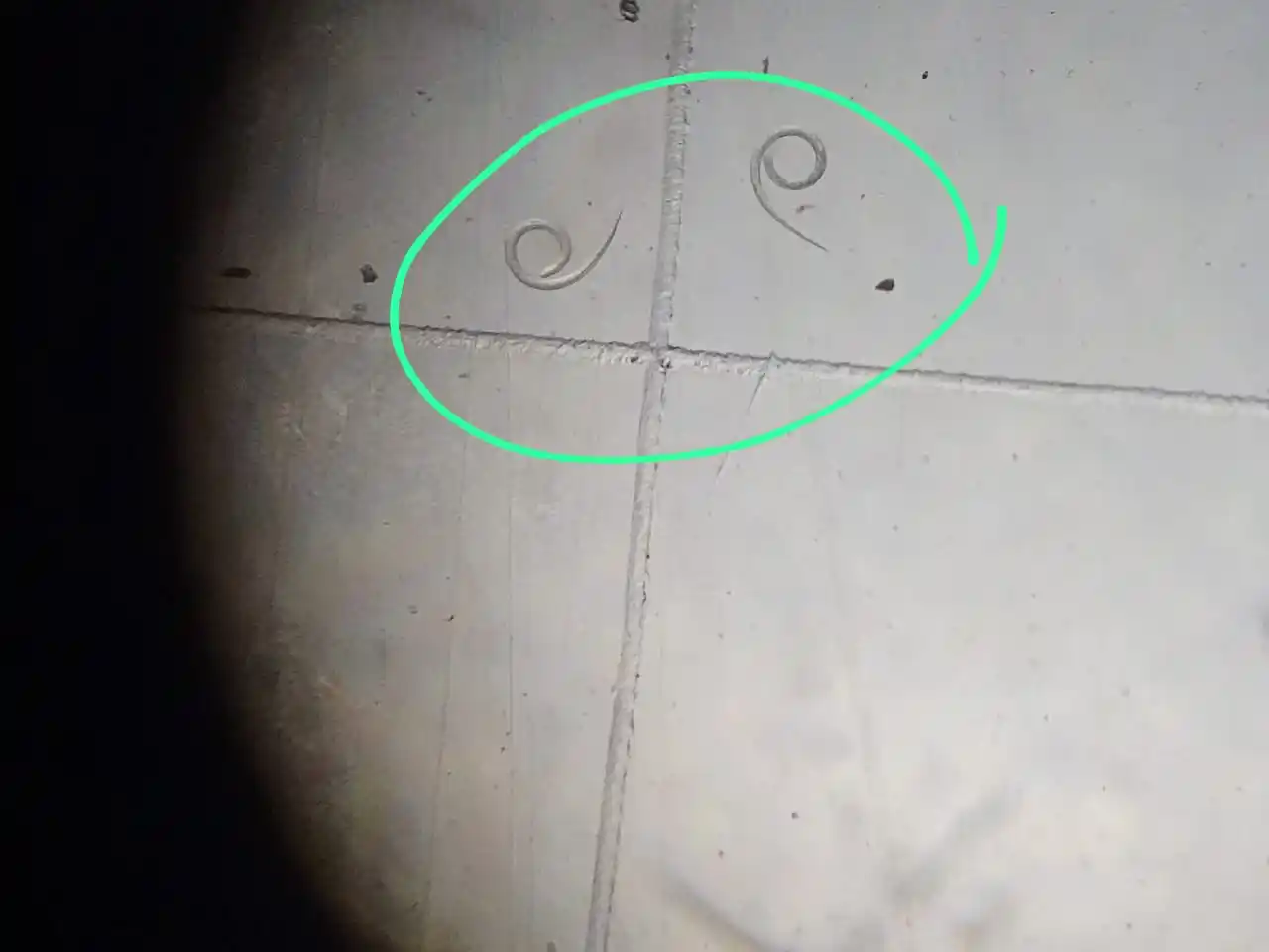 Larvas de triquinosis