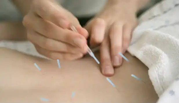 El 40 por ciento de los argentinos eligen la medicina alternativa como primera opción 