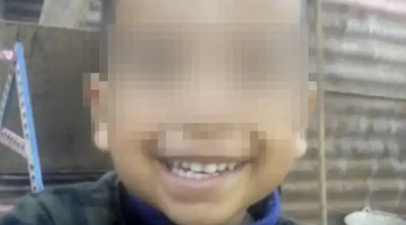 Un pitbull le desfiguró la cara a un nene de 3 años
