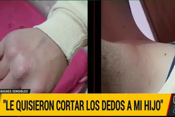 Vecinos culparon una pareja de robar una bici: le cortaron los dedos y la manosearon por "error"