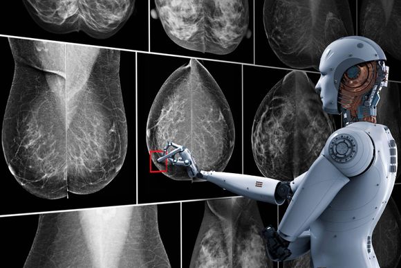 Cáncer de mamas puede ser detectado gracias a la Inteligencia Artificial