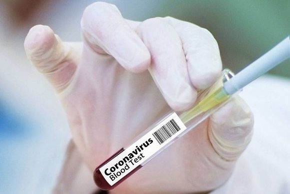 Cada persona curada de Covid-19 produce diferentes tipos de anticuerpos