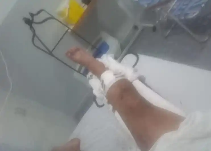 Juntan dinero para comprar la prótesis del motociclista que chocó un Falcon estacionado