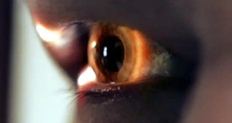 Exámenes oculares gratuitos: este viernes comienza la campaña de detección del Glaucoma