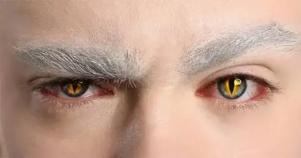 Alerta por el uso de lentes de contacto cosméticas sin control en Halloween