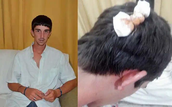 Urdinarrain: Joven denunció golpiza de la Policía 
