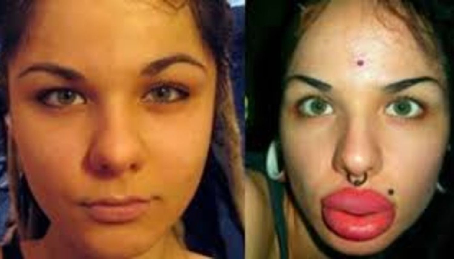 Una joven se operó 100 veces para tener los labios más grandes del mundo