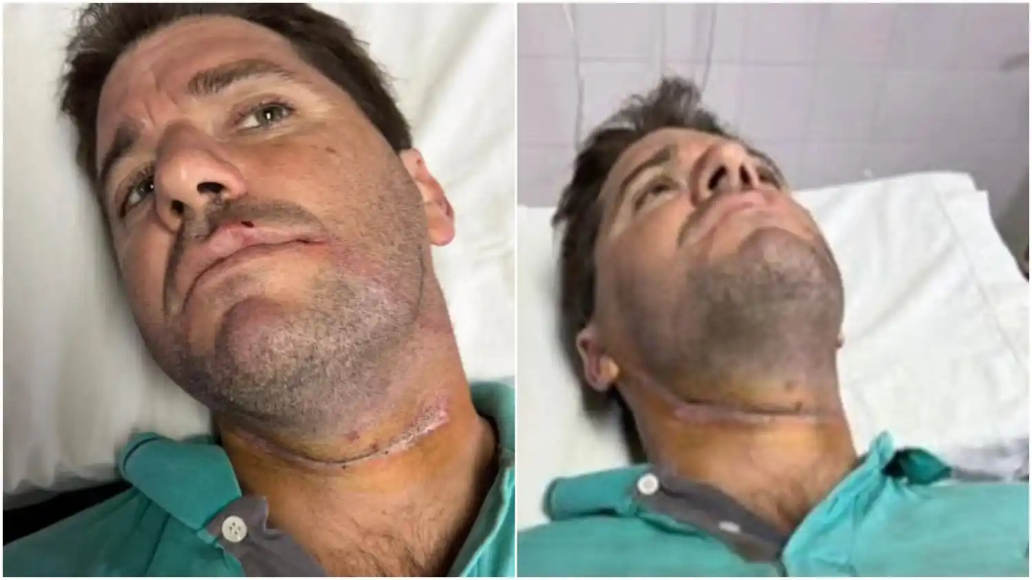 Un motociclista se enredó con un cable suelto y casi muere "decapitado" en Carlos Casares: "Pensé que no la contaba"