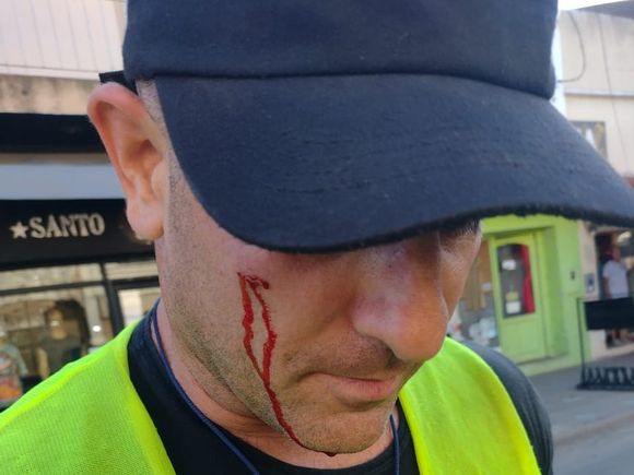 Momento violento: un inspector lesionado por un motociclista que se dio a la fuga en un control de tránsito