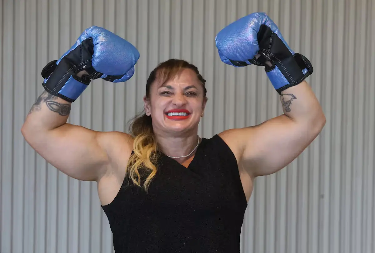 Alejandra "Locomotora" Oliveras tiene un "daño irreversible" en el cerebro