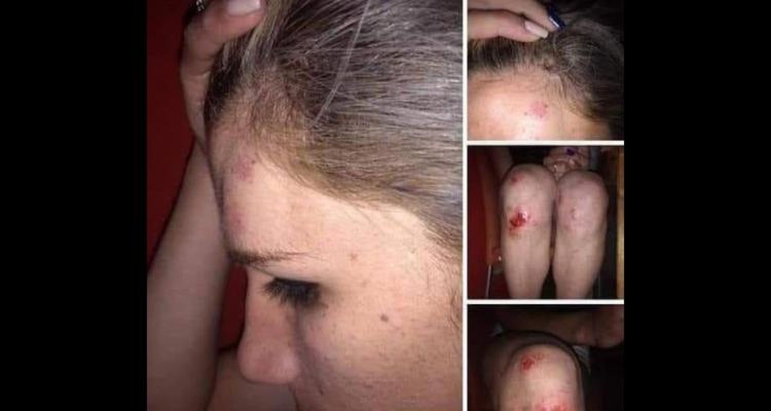 Discriminación en Baradero: Golpearon salvajemente a una chica trans
